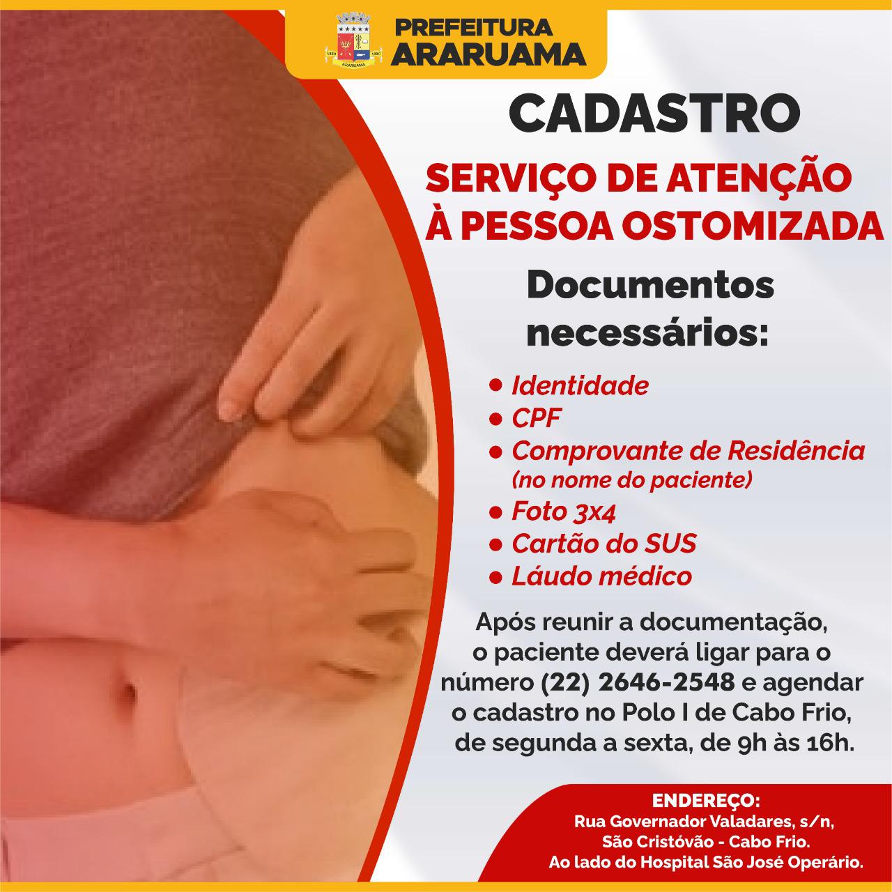 Prefeitura de Araruama informa: Serviço de atenção à pessoa ostomizada é oferecido a todos os pacientes da Rede Pública de Saúde do Estado do Rio